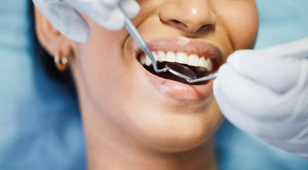 Best Walk-In Emergency Dentist in Tano Road, NM