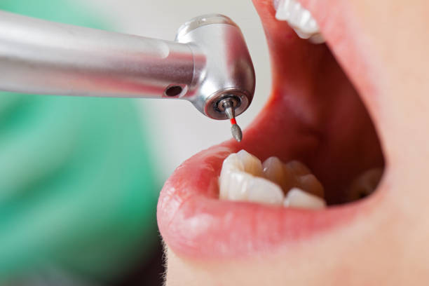 Best Emergency Broken Tooth Repair in Tano Road, NM